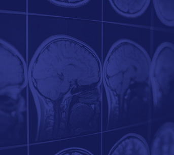 Brain Injuries